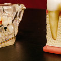 Georgetown's Dental Revolution: The Harmony Of Dental Implants And Endodontics