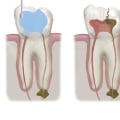 Preparing for an Endodontic Appointment: What You Need to Know
