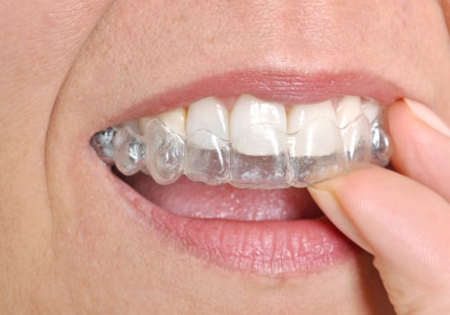 The Connection Between Endodontics And Invisalign: Achieving A Perfect Smile In Cedar Park