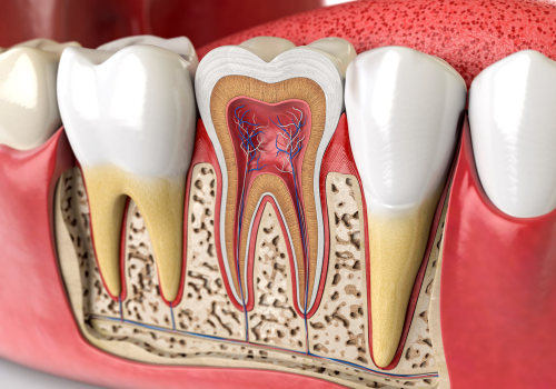 Why an Endodontist is the Best Choice for Root Canal Treatment