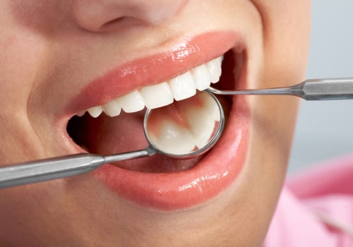 Preserving Natural Teeth: The Ultimate Goal of Endodontics